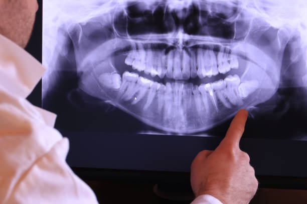 Best Emergency Wisdom Teeth Removal in Sloan, IA